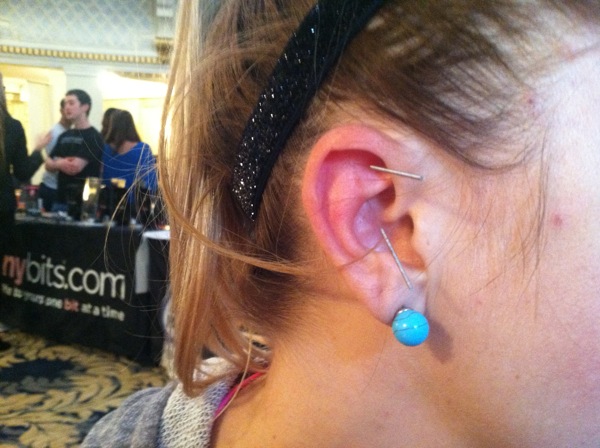 Accupuncture Ear.jpg 2013 01 13 13 14 13